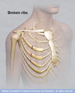 When are Alba's ribs going to heal?